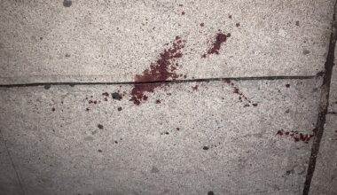 Norwood: Man Hospitalized after Stabbing on East 207th Street, Three Males Sought