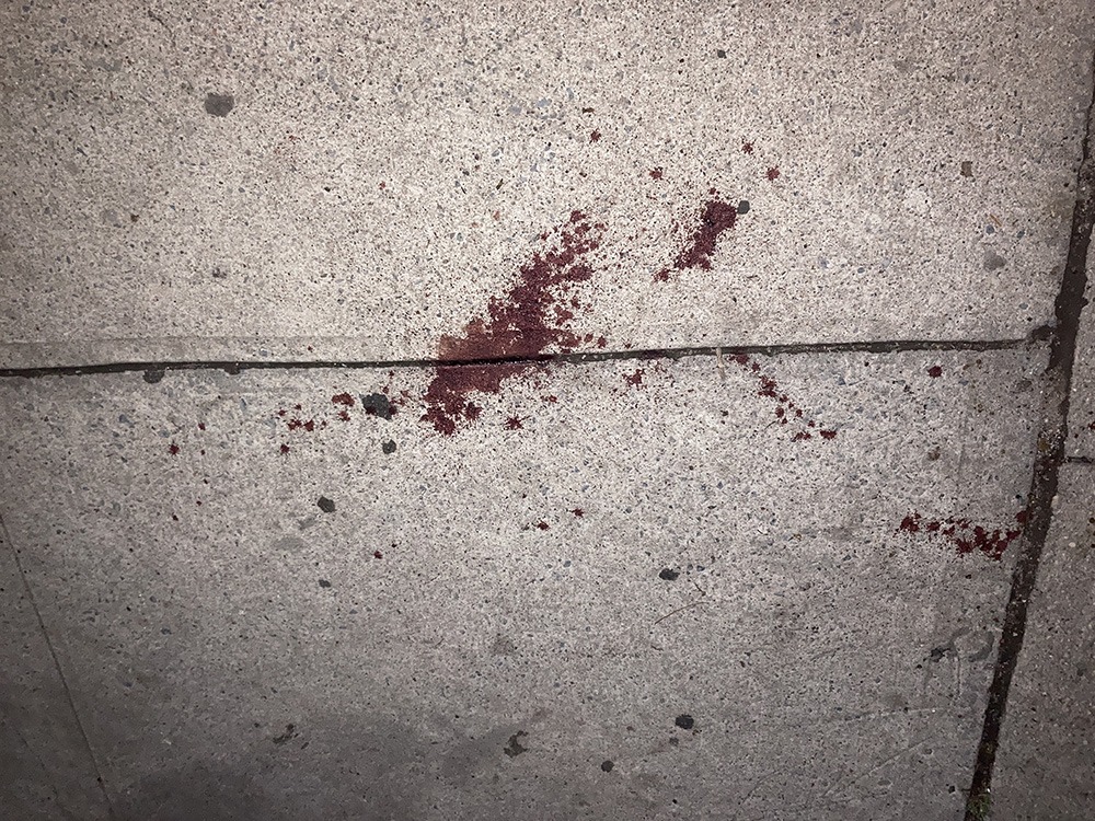 Norwood: Man Hospitalized after Stabbing on East 207th Street, Three Males Sought