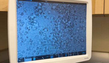 Albany researchers may have found way to 'silence' HIV