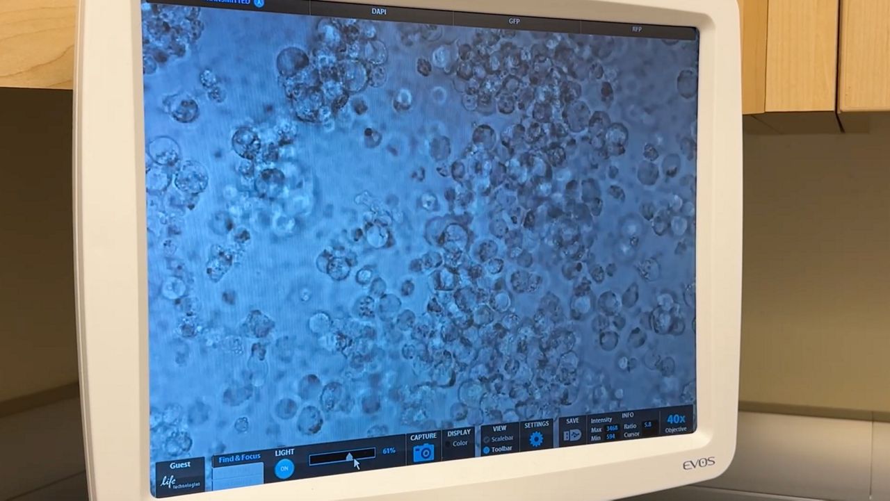 Albany researchers may have found way to 'silence' HIV