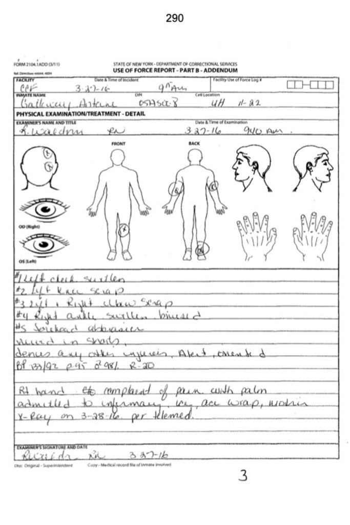 A use of force report documented injuries to East Flatbush resident Antoine Galloway after he says after officers at the Clinton Correctional Facility in Upstate assaulted him.