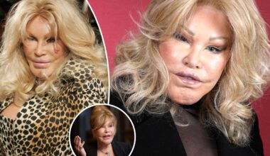 New York needs more wackos like the surgery addict Catwoman