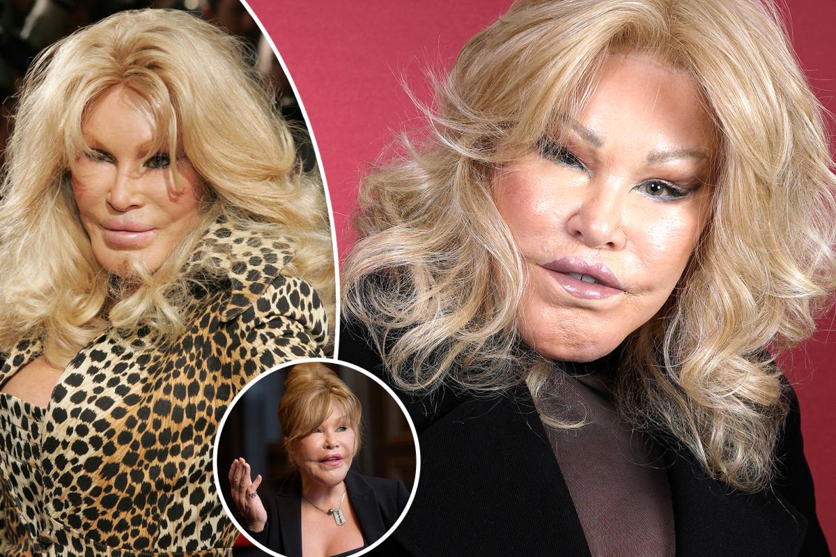 New York needs more wackos like the surgery addict Catwoman