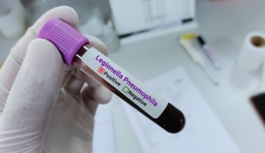 NYC Legionella inspections rose only gradually before latest Legionnaires' cluster in Manhattan