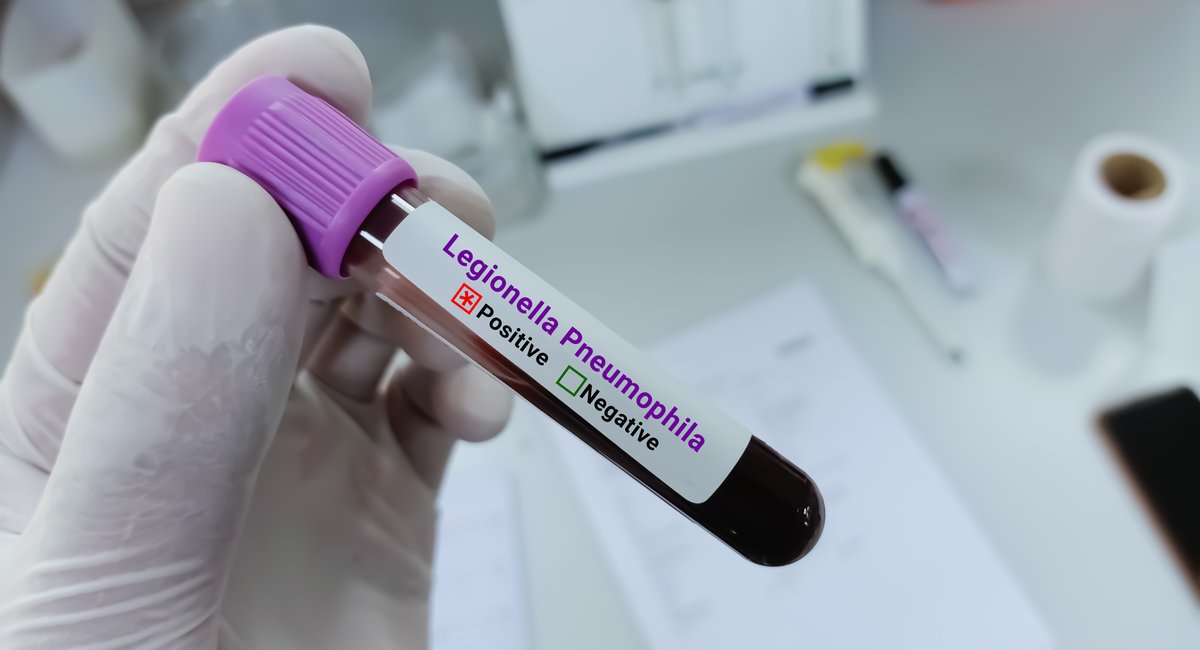 NYC Legionella inspections rose only gradually before latest Legionnaires' cluster in Manhattan