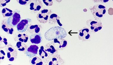 Deadly Brain-Eating Amoeba Season Returns To New York
