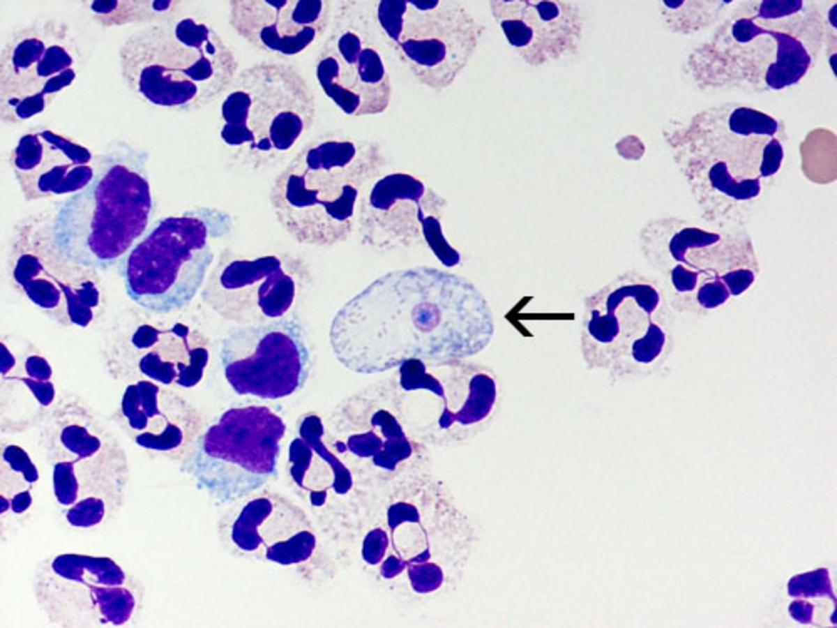 Deadly Brain-Eating Amoeba Season Returns To New York