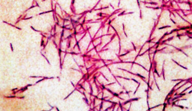 Nearly 2 dozen sickened in Legionnaires' disease cluster in New York City