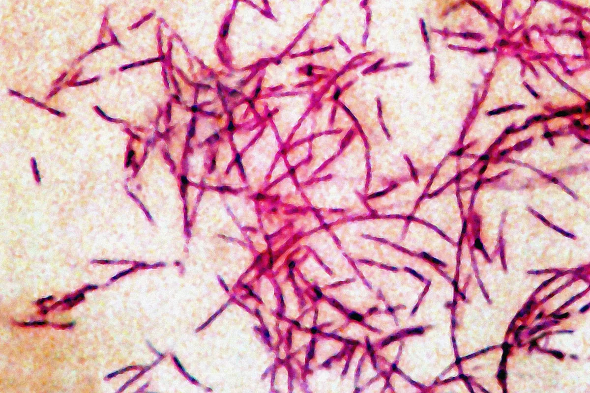Nearly 2 dozen sickened in Legionnaires' disease cluster in New York City