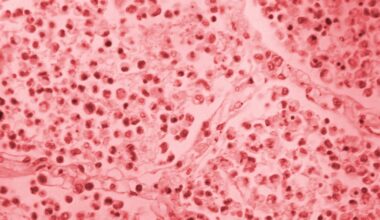 Upper East Side Legionnaires’ cluster grows to 54 cases