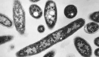 First death reported in Legionnaires' disease outbreak in New York City