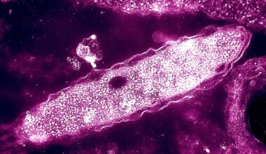 Four deaths reported in New York City Legionnaires’ disease cluster