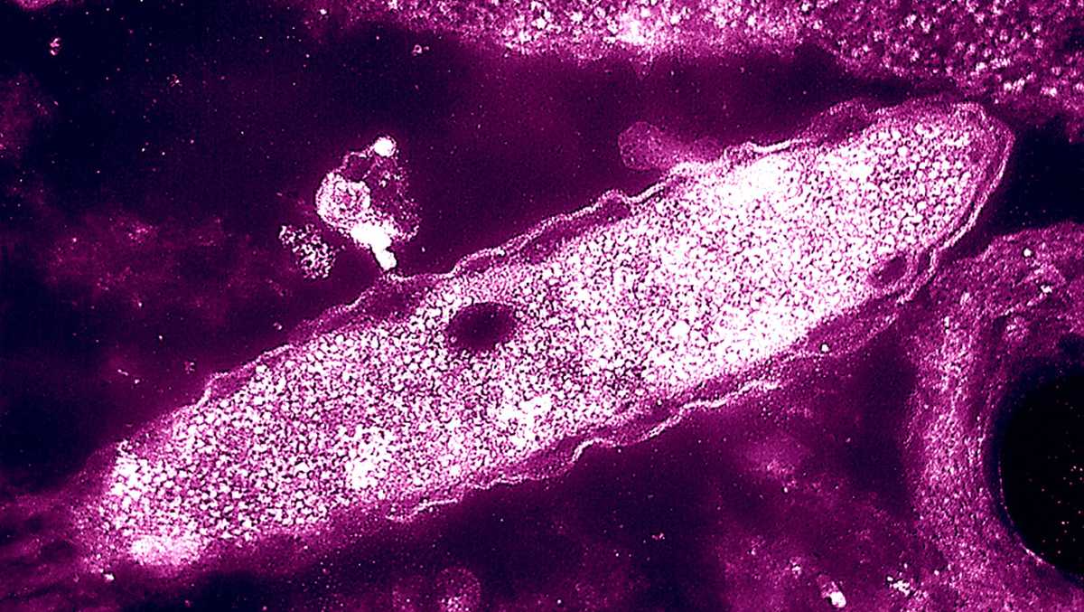 Four deaths reported in New York City Legionnaires’ disease cluster
