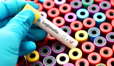 New York City Legionnaires' disease kills 4 on the Upper East Side