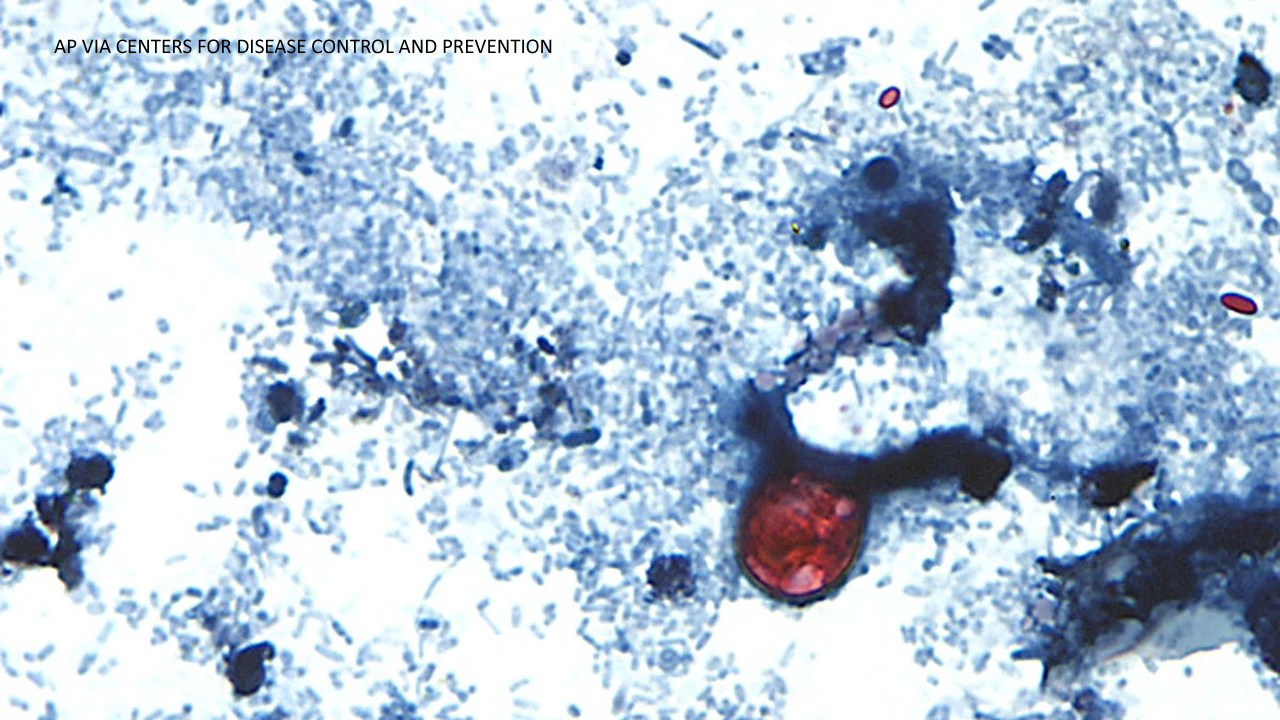 This undated photo taken through a microscope provided by the CDC shows Cyclospora cayetanensis oocysts found in a fresh stool sample which had been prepared with a formalin solution and stained with safranin.