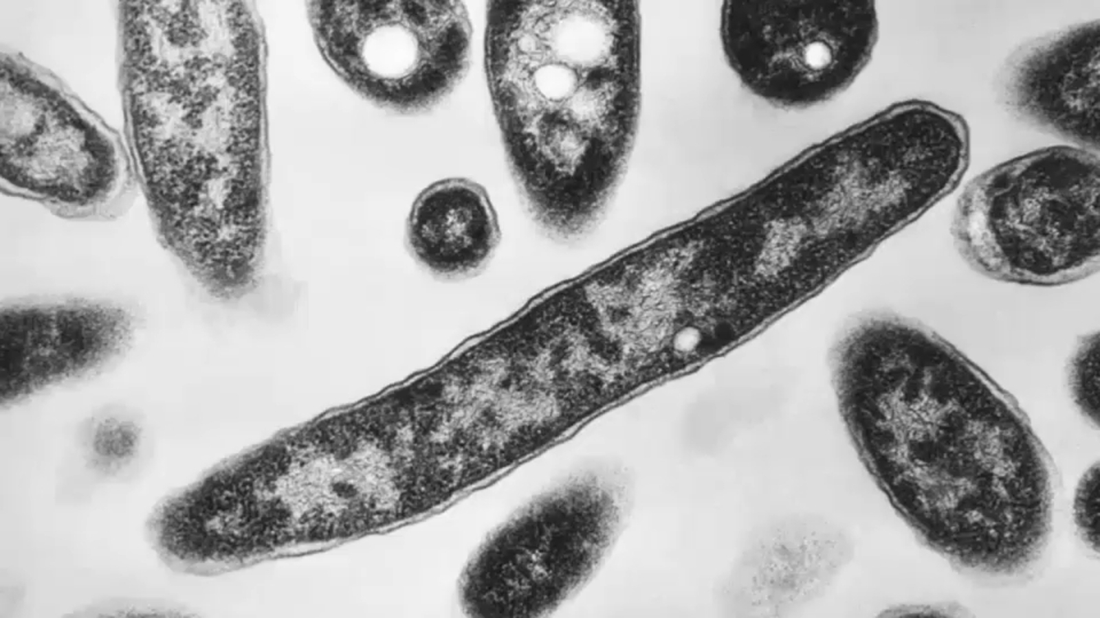 NYC Legionnaires' outbreak: New York City health department says UES cluster exposure has ended