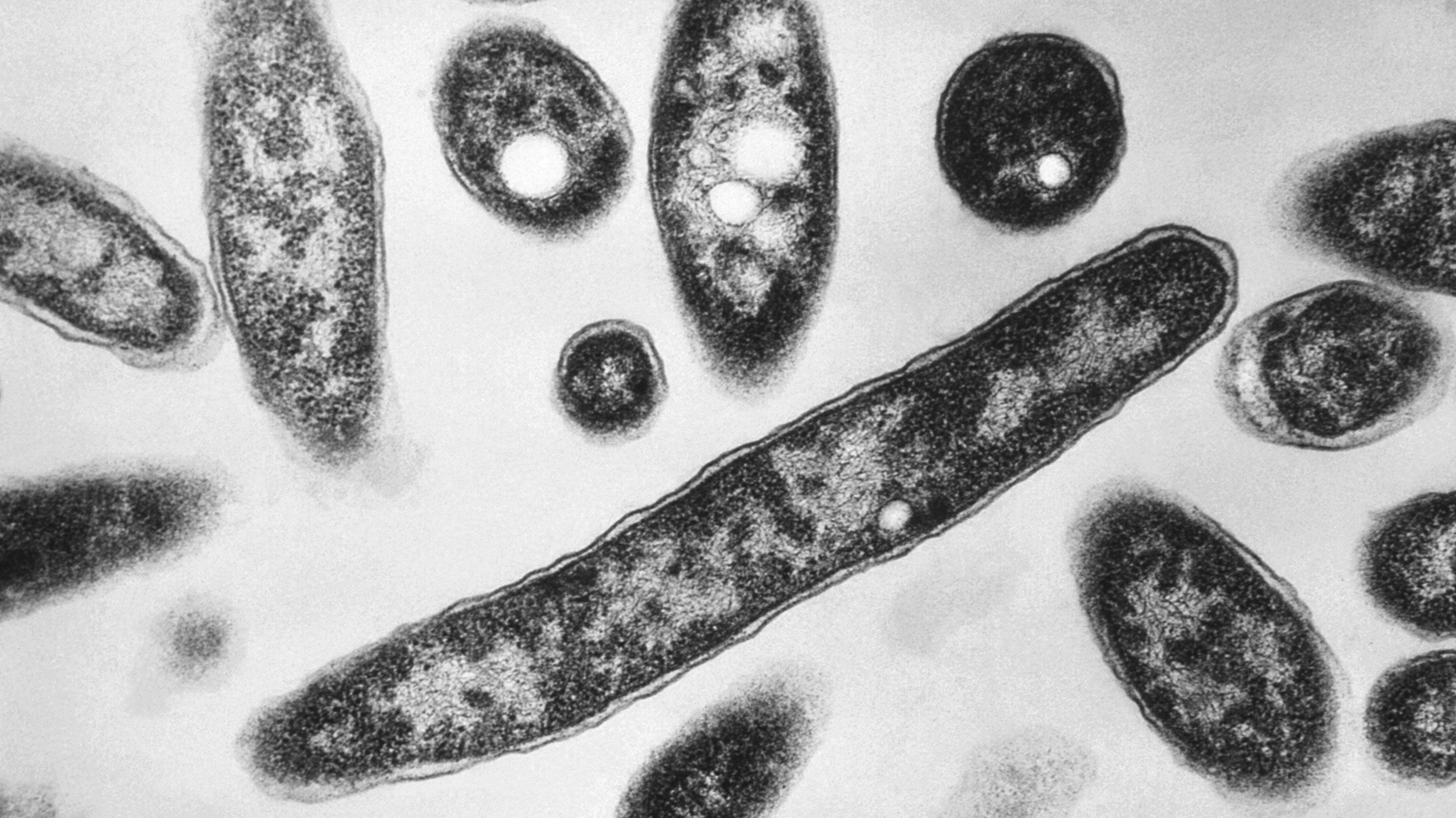 New York City Legionnaires' disease outbreak linked to 7 deaths is declared over