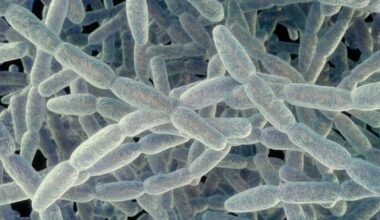 What to know about the severe pneumonia cluster on the Upper East Side