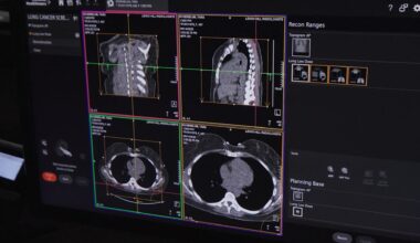 News 12 | Brooklyn | How Ai And New Tech Are Fighting The Tri States Deadliest Cancer