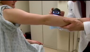 Doctors warn against risky ‘tanmaxxing’ trend touted by influencers – NBC New York