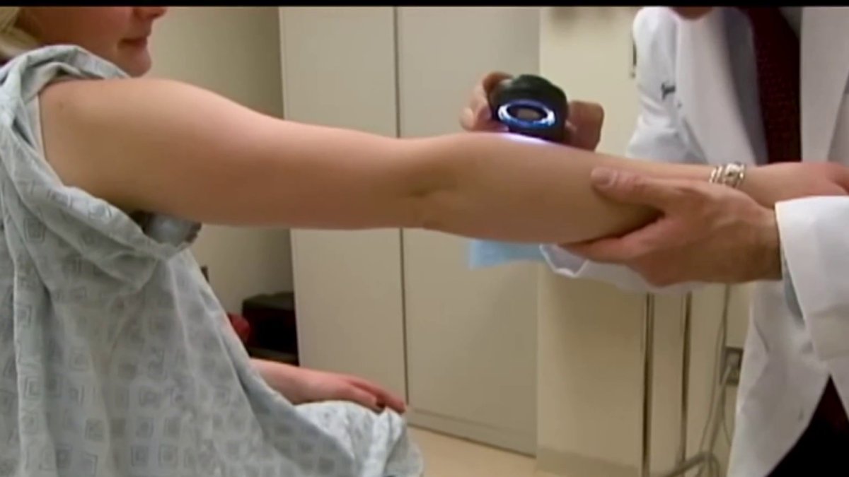 Doctors warn against risky ‘tanmaxxing’ trend touted by influencers – NBC New York
