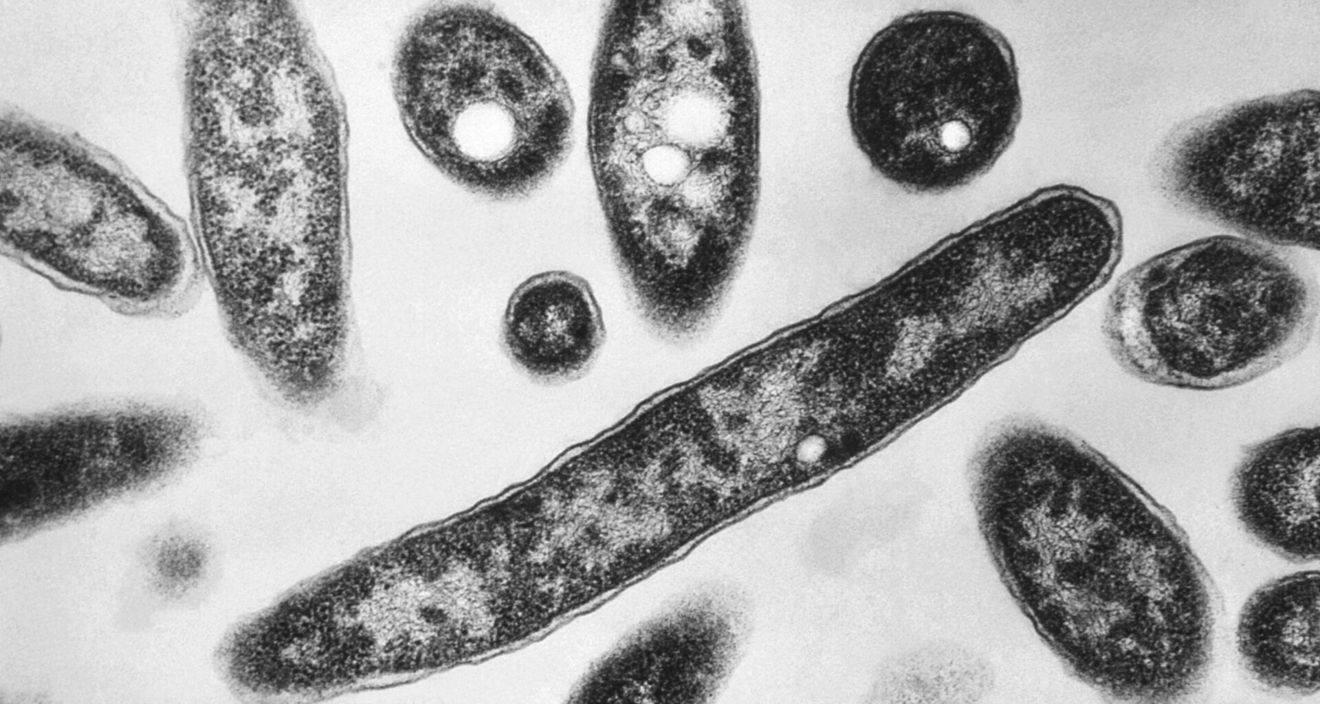 FILE - This 1978 electron microscope image made available by the Centers for Disease Control and Prevention shows Legionella pneumophila bacteria which are responsible for causing the pneumonic disease Legionnaires' disease. (Francis Chandler/CDC via AP, File)