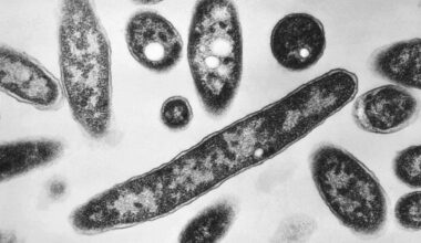Two stricken with Legionnaires Disease on Upper East Side, cluster investigated: NYC health officials