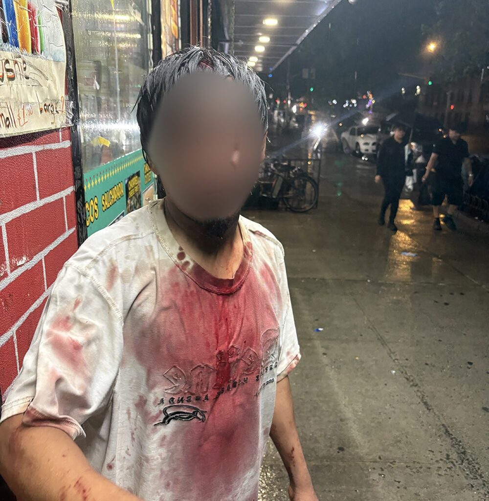 Norwood: Man Seemingly Stabbed in Head and Leg on East Gun Hill Road