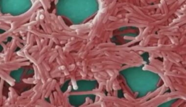 Sixth person dies from Manhattan Legionnaries’ disease outbreak – NBC New York