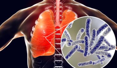 Here’s how to sign up for Monday’s Legionnaires’ Virtual Town Hall – NBC New York