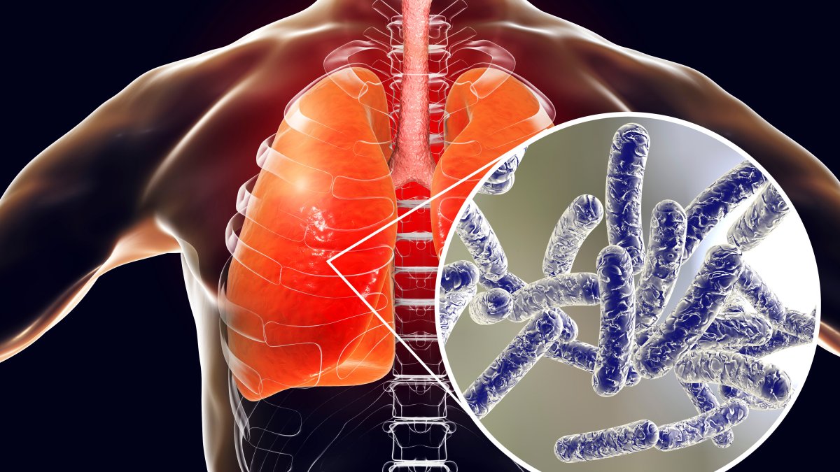 Here’s how to sign up for Monday’s Legionnaires’ Virtual Town Hall – NBC New York
