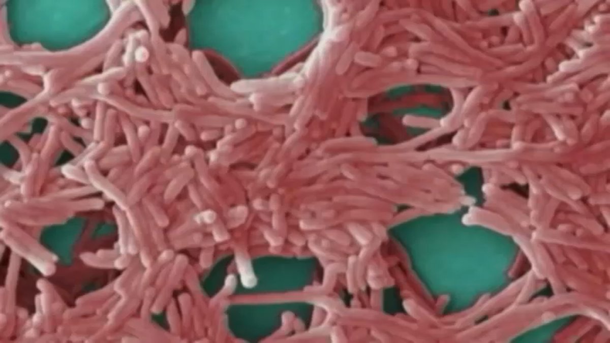 Sixth person dies from Manhattan Legionnaries’ disease outbreak – NBC New York