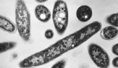 Legionnaires' disease