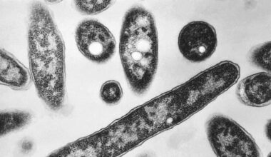 Legionnaires’ disease cluster in New York City takes third life – Deseret News