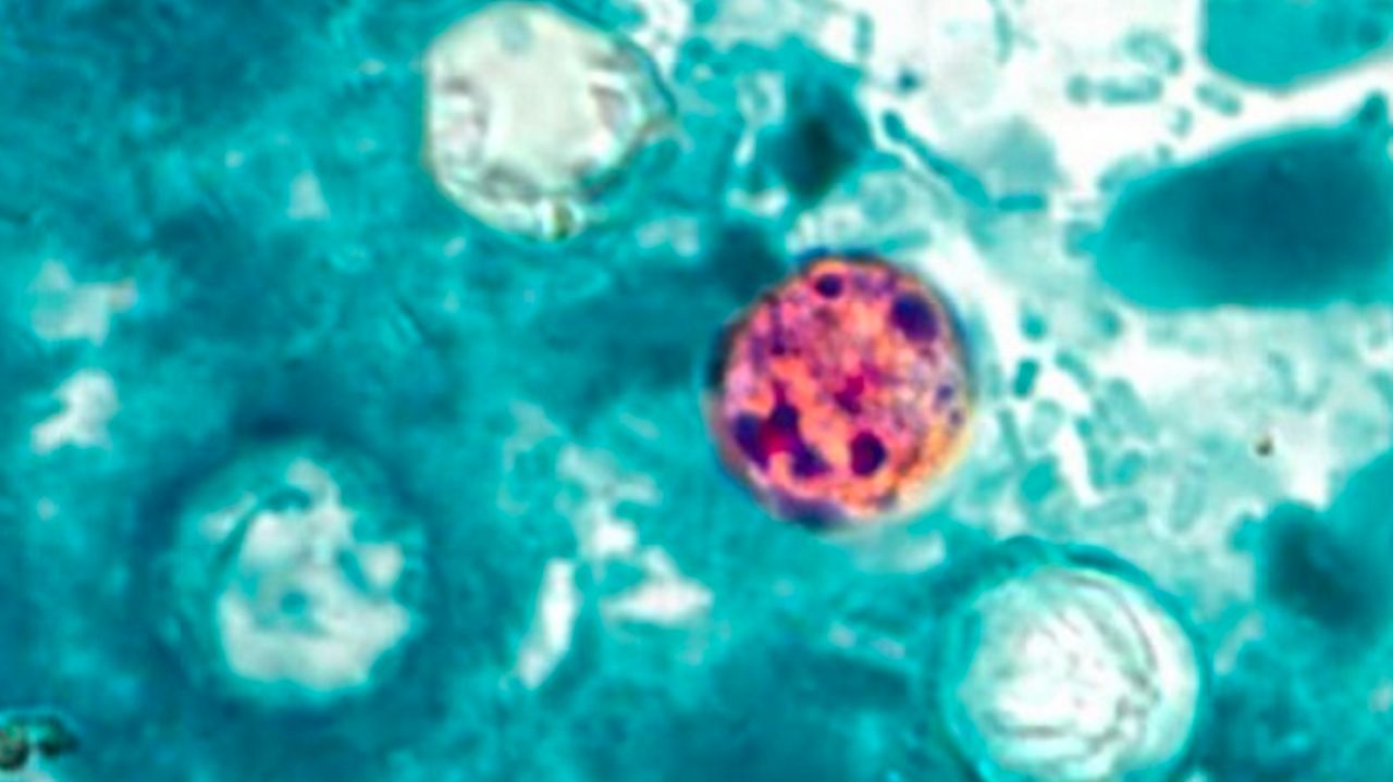 Cyclosporiasis cases climb upstate as parasite spreads