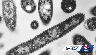 Doc talks Legionnaires after 3 killed, dozens hospitalized from disease in NYC