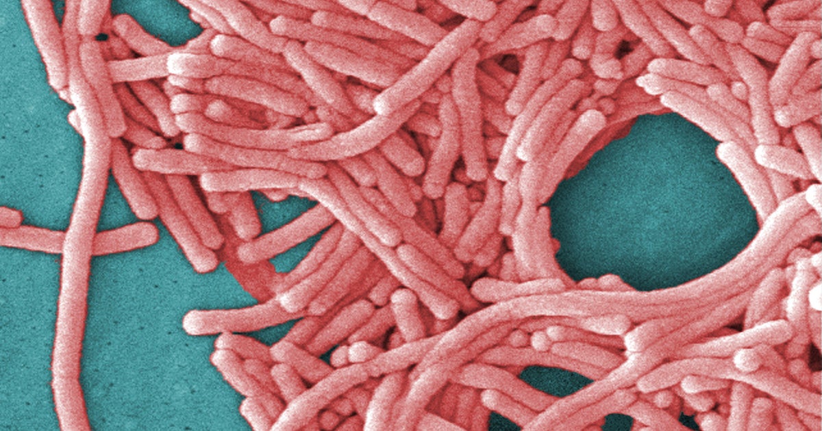 10 Legionnaires' disease cases on NYC's Upper East Side under investigation, health officials say