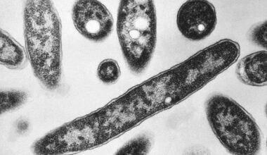 Seventh Death Reported In UES Legionnaires' Disease Outbreak