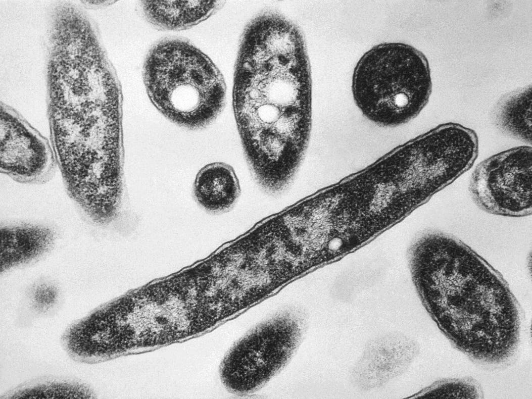 Seventh Death Reported In UES Legionnaires' Disease Outbreak