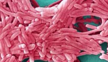 NYC Health Department to give Legionnaires' update after 7th death in Upper East Side cluster