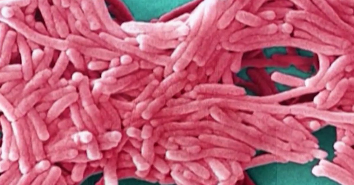 NYC Health Department to give Legionnaires' update after 7th death in Upper East Side cluster