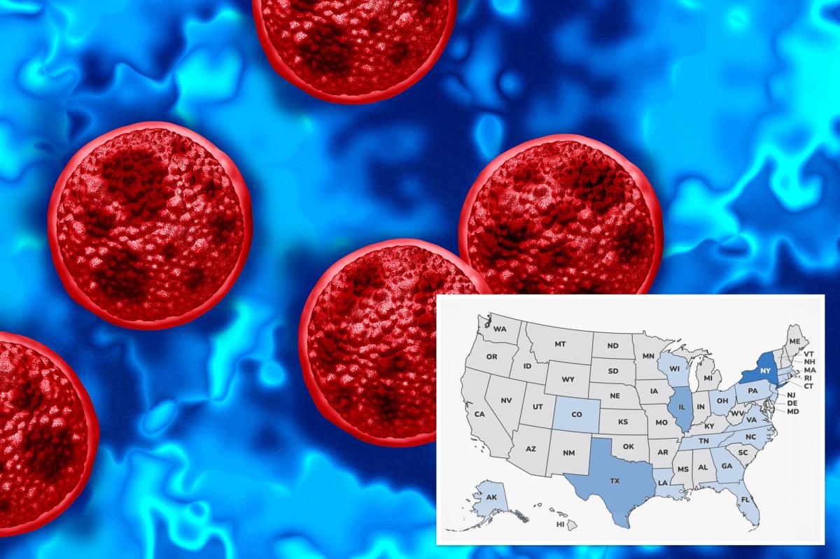 'Explosive diarrhea' parasite invades Long Island as separate bacteria outbreak sickens dozens after music festival