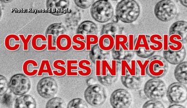 Cyclosporiasis in NYC tops 440 cases as health department investigates