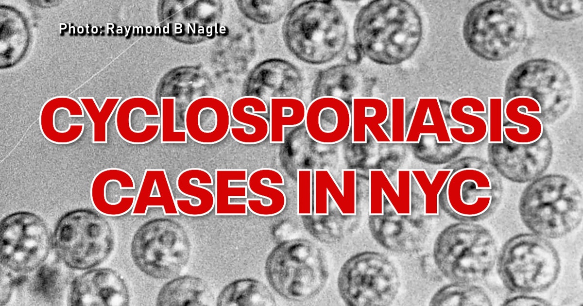 Cyclosporiasis in NYC tops 440 cases as health department investigates