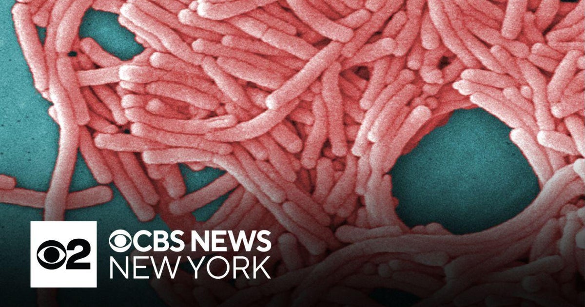 31 sickened in NYC Legionnaires' cluster discharged from hospital, officials say - CBS News