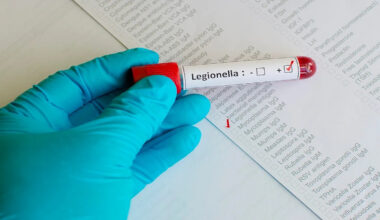 NYC Legionnaires' disease outbreak kills fourth victim, 76 cases reported
