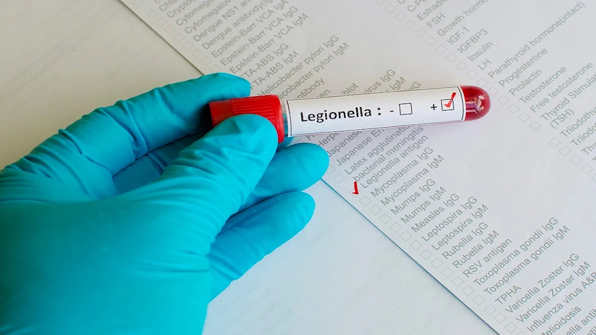 NYC Legionnaires' disease outbreak kills fourth victim, 76 cases reported