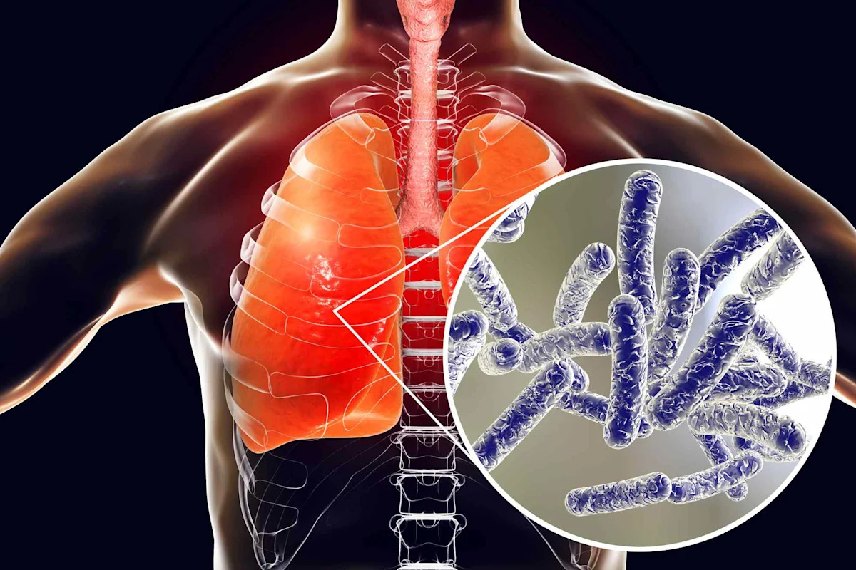 5 Dead and 82 Sickened amid Legionnaires’ Disease Outbreak in New York City’s Upper East Side