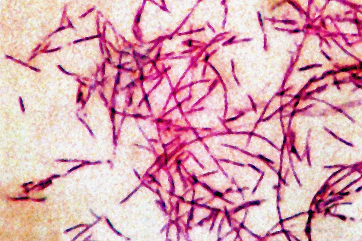 6th person dies from Legionnaires' disease in New York City: Health officials