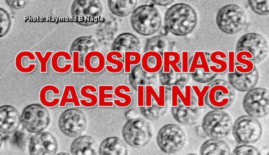 Cyclosporiasis in NYC tops 440 cases as health department investigates
